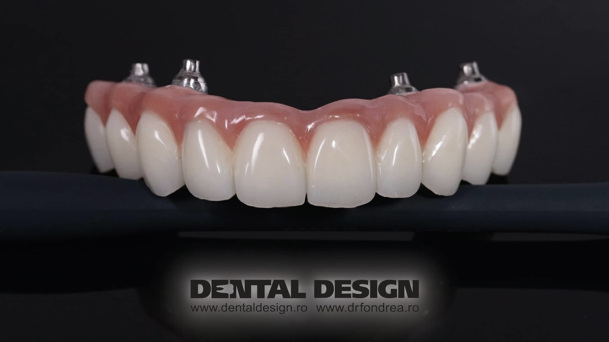 dantura fixa pe implanturi dentare, dental design timisoara