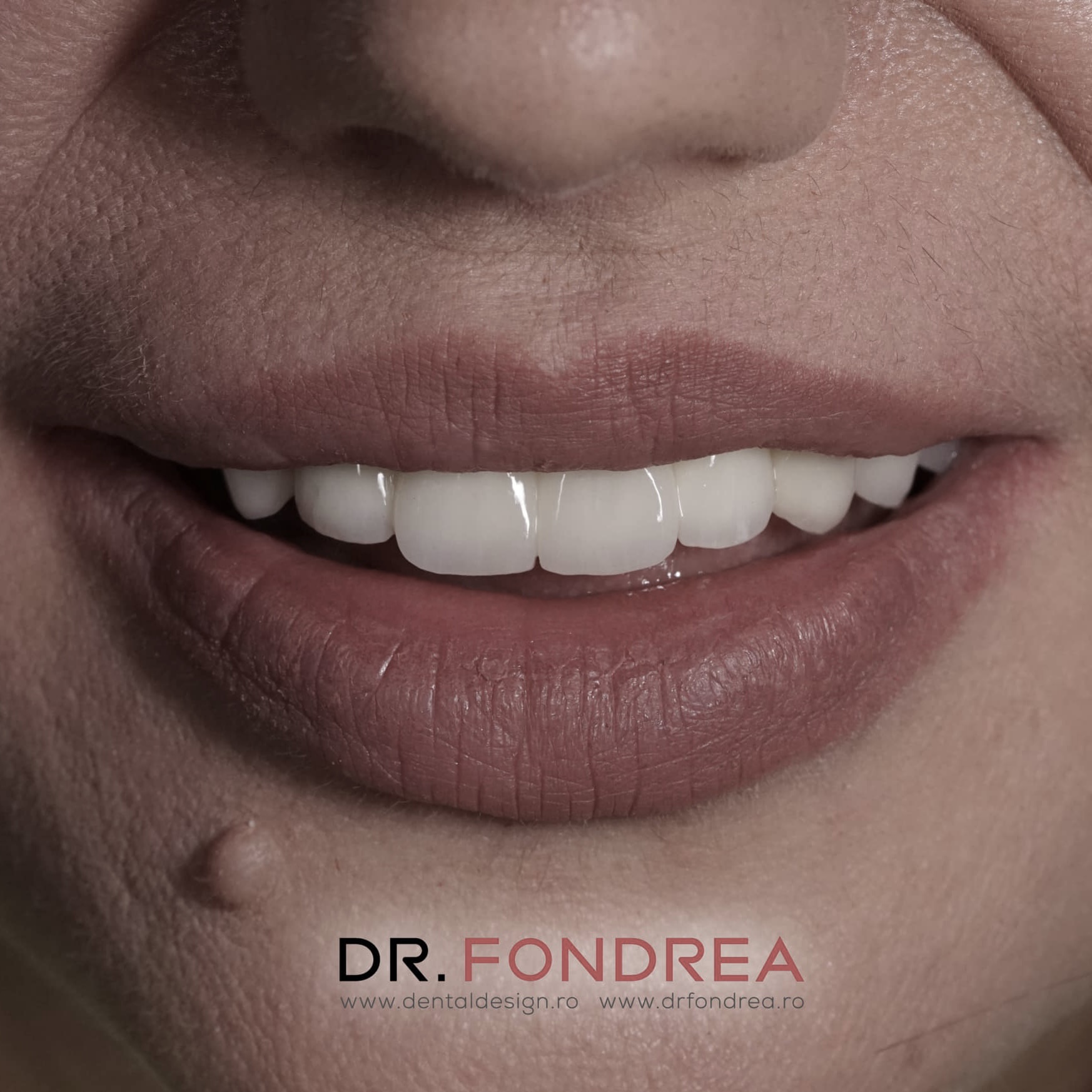 dental design timisoara, dr fondrea bogdan