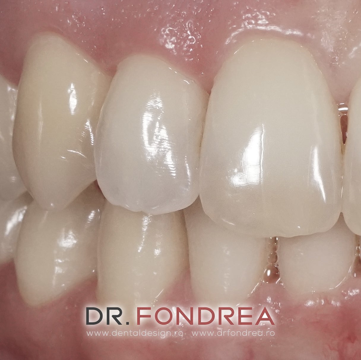 dental design timisoara, dr fondrea bogdan