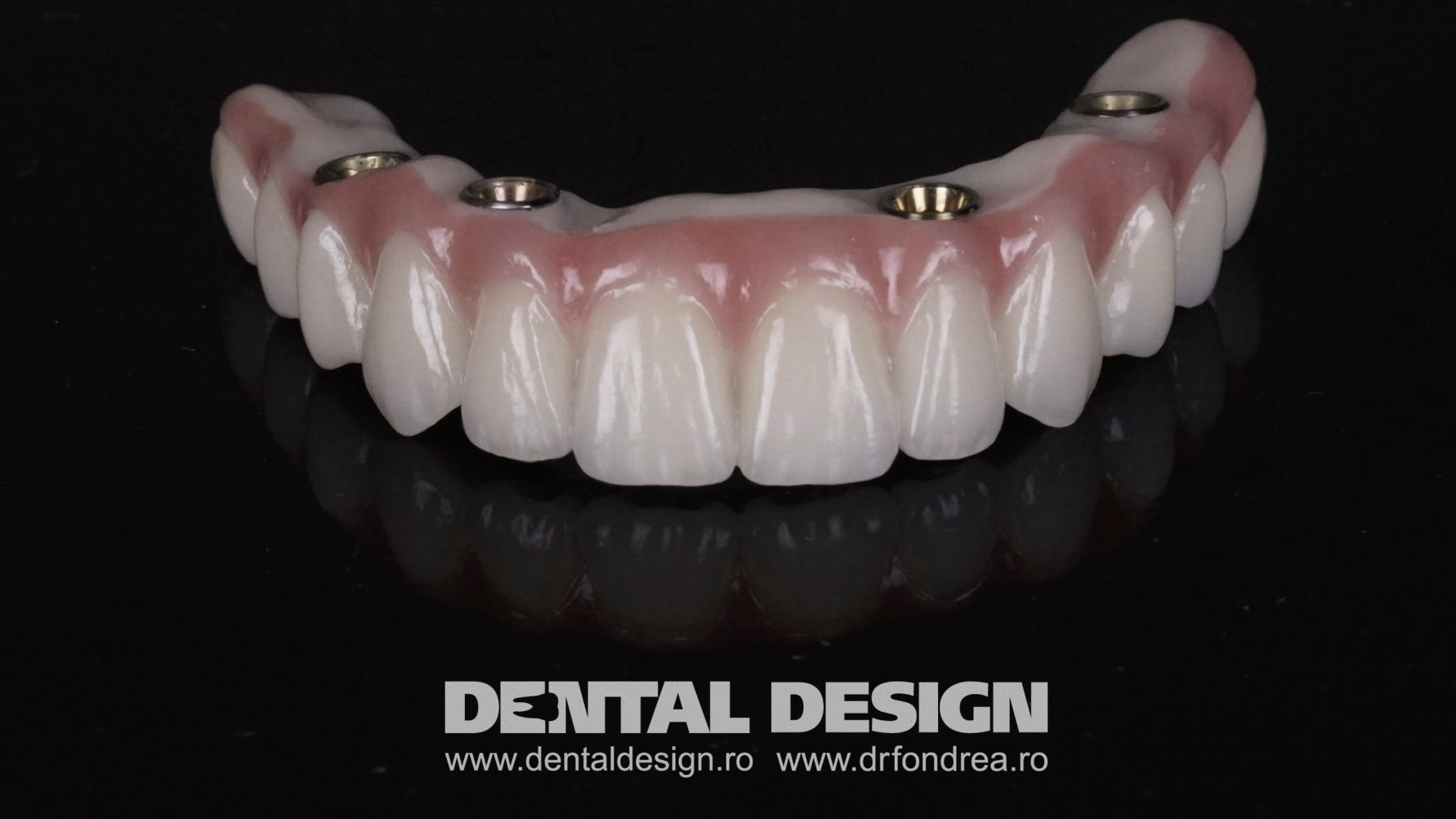 implanturi dentare, dantura fixa, dental design timisoara dr fondrea bogdan