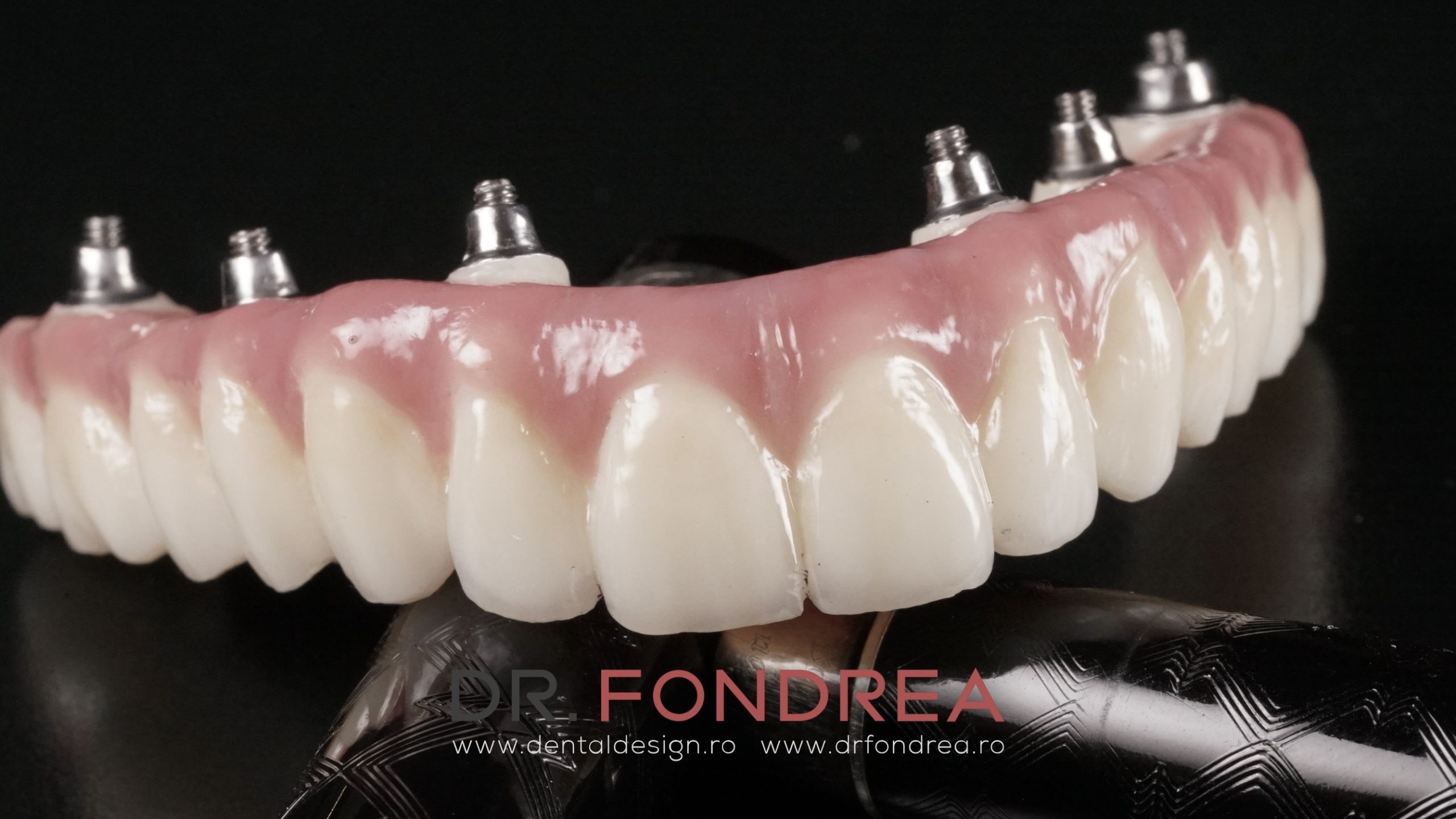 dental design timisoara, dr fondrea bogdan