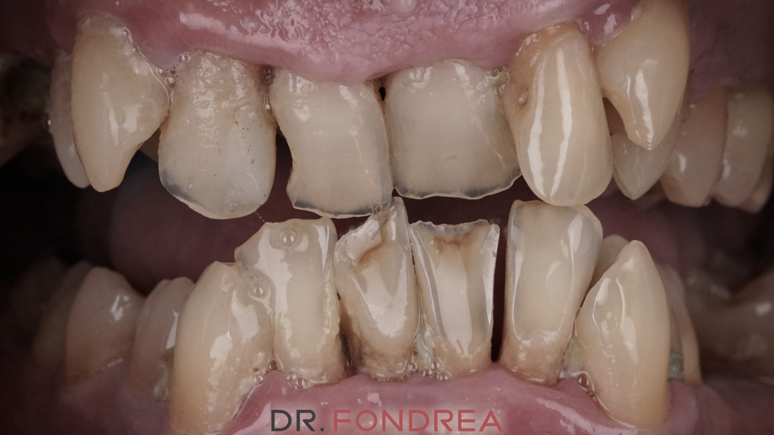 dental design timisoara, dr fondrea bogdan