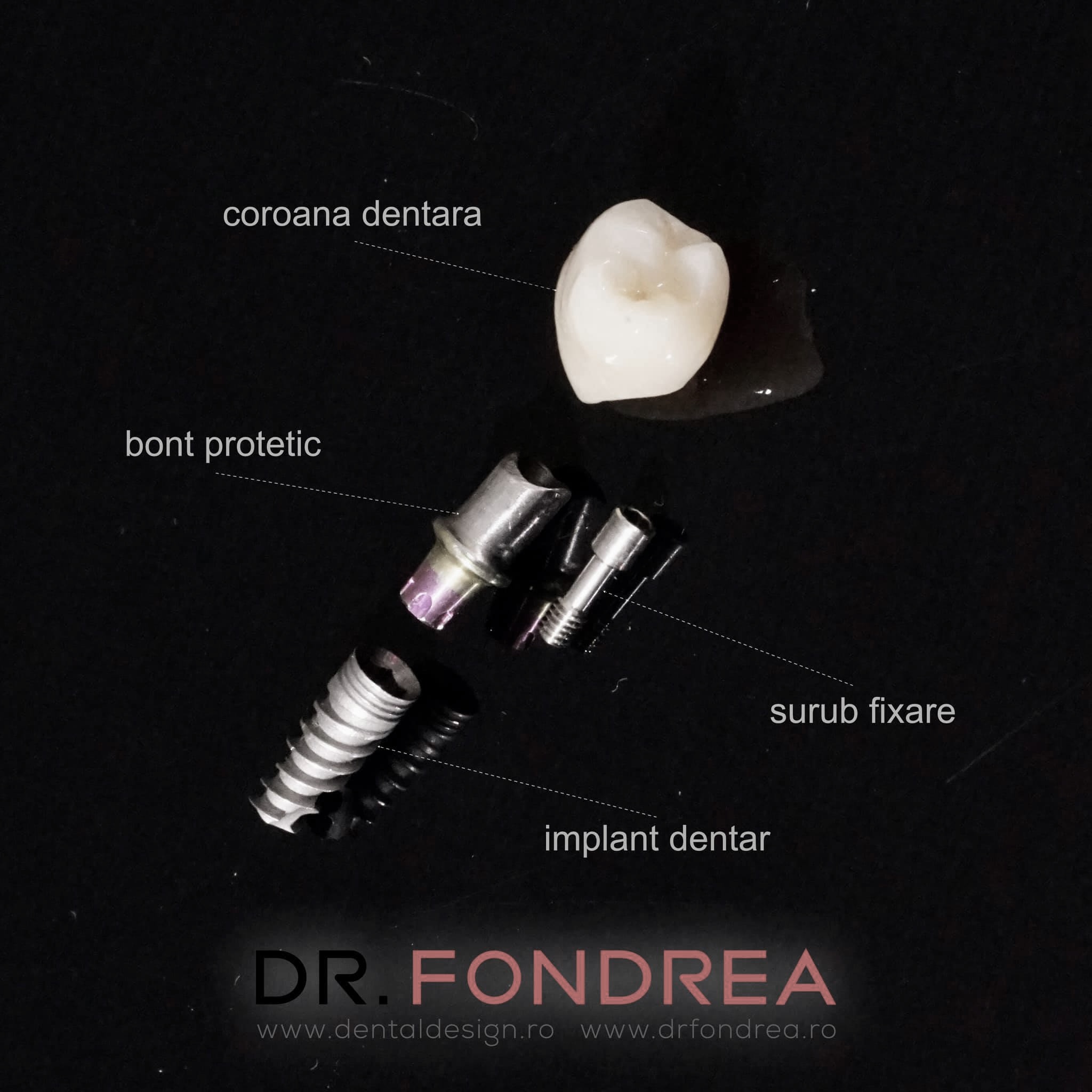 dental design dr fondrea timisoara